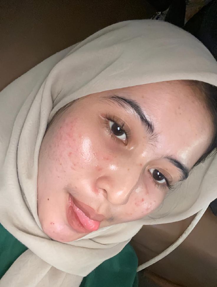 Viral Indonesia Hijab Abg 2025 Terbaru Indo Yang Masih Gurih Dan Kriuk Jadi Pusat Icikiwir Global Trending Top New